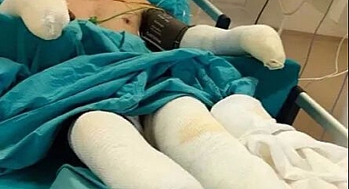 Alevlerin Arasından Çıkan Kahramanın Son Hali Paylaşıldı