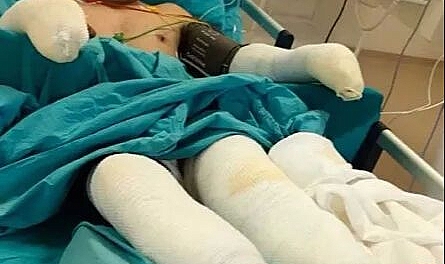 Alevlerin Arasından Çıkan Kahramanın Son Hali Paylaşıldı